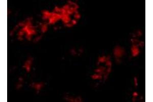 Immunofluorescence of BMF in human kidney tissue with BMF polyclonal antibody  at 10 ug/mL . (BMF 抗体  (C-Term))