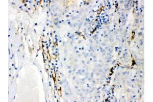 Immunohistochemistry (IHC) image for anti-Cytochrome P450, Family 1, Subfamily B, Polypeptide 1 (CYP1B1) (AA 255-480) antibody (ABIN3042785)