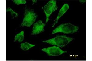 Immunofluorescence of monoclonal antibody to MAPK13 on HeLa cell. (MAPK13 抗体  (AA 251-365))