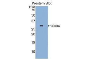 Western Blotting (WB) image for anti-FK506 Binding Protein 10, 65 KDa (FKBP10) (AA 316-573) antibody (ABIN1858893) (FKBP10 抗体  (AA 316-573))