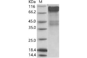 Western Blotting (WB) image for Bundibugyo Ebola Virus Envelope Glycoprotein (BEBOV GP) protein (His tag) (ABIN7198902) (BEBOV GP Protein (His tag))