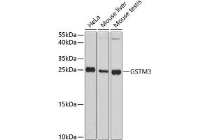 Western blot analysis of extracts of various cell lines, using GSTM3 antibody (ABIN1680137, ABIN3018259, ABIN3018260 and ABIN6220417) at 1:3000 dilution. (GSTM3 抗体  (AA 101-225))