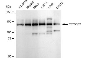 anti-Tumor Protein P53 Binding Protein 2 (TP53BP2) antibody