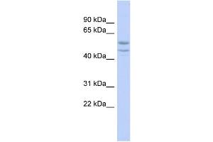 WB Suggested Anti-SOHLH2 Antibody Titration:  0. (SOHLH2 抗体  (Middle Region))