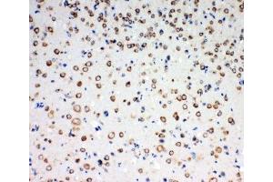 Immunohistochemistry (IHC) image for anti-Neurotrophic tyrosine Kinase, Receptor, Type 3 (NTRK3) (AA 167-182) antibody (ABIN3028867)