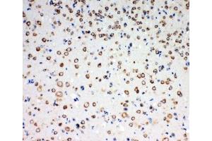 IHC-P: TrkC antibody testing of rat brain tissue (NTRK3 抗体  (AA 167-182))