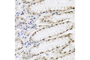 Immunohistochemistry of paraffin-embedded human stomach using SRSF9 antibody (ABIN5973601) (40x lens). (SFRS9 抗体)