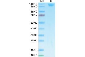 SDS-PAGE (SDS) image for SARS-CoV-2 Spike S1 protein (Fc-Avi Tag,Biotin) (ABIN7275553)