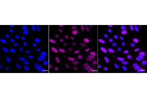 Immunocytochemical staining of HepG2 cells with RAD23A antibody (ABIN7800116), 1:1,000).