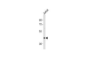 Anti-OXTR Antibody (C-term)at 1:1000 dilution + Jurkat whole cell lysates Lysates/proteins at 20 μg per lane. (Oxytocin Receptor 抗体  (C-Term))