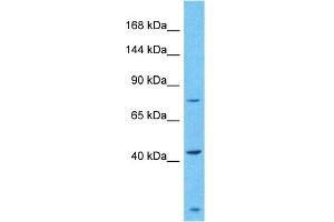 Host:  Rabbit  Target Name:  ZSC29  Sample Type:  Fetal Liver lysates  Antibody Dilution:  1. (ZSCAN29 抗体  (C-Term))