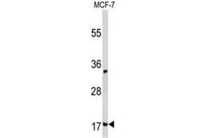 Western blot analysis of Destrin  Antibody  in MCF-7 cell line lysates (35ug/lane). (Destrin 抗体  (Middle Region))