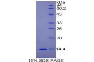 SDS-PAGE analysis of Human DDT Protein. (DDT 蛋白)