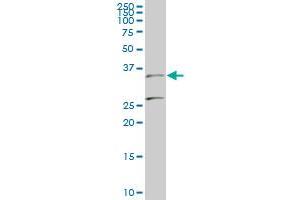 BARHL1 monoclonal antibody (M01), clone 2B11 Western Blot analysis of BARHL1 expression in PC-12 . (BARHL1 抗体  (AA 55-154))