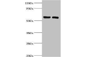 Western blot All lanes: ADP-ribosylation factor-binding protein GGA2 antibody at 10 μg/mL Lane 1: Rat brain tissue Lane 2: Mouse liver tissue Secondary Goat polyclonal to rabbit IgG at 1/10000 dilution Predicted band size: 67 kDa Observed band size: 67 kDa (GGA2 抗体  (AA 1-300))