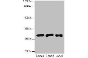 Western blot All lanes: ETHE1 antibody at 8 μg/mL Lane 1: Mouse liver tissue Lane 2: HepG2 whole cell lysate Lane 3: Hela whole cell lysate Secondary Goat polyclonal to rabbit IgG at 1/10000 dilution Predicted band size: 28 kDa Observed band size: 28 kDa (ETHE1 抗体  (AA 8-254))