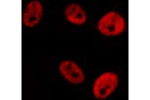 ABIN6276281 staining  Hela cells by IF/ICC. (STAT1 抗体  (C-Term))