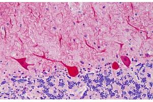 Human Cerebellum: Formalin-Fixed, Paraffin-Embedded (FFPE) (CARD11 抗体  (AA 18-238))