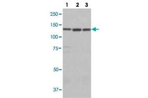 Western blot analysis of lane 1: A549 cell lysate, lane 2: HEK293 cell lysate and lane 3: HeLa cell lysate using LARS polyclonal antibody . (LARS 抗体)