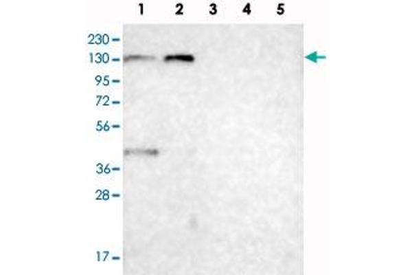 Chromosome 6 Open Reading Frame 170 (C6ORF170) Antikörper
