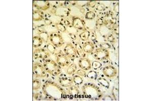 H6PD Antibody (C-term) (ABIN651229 and ABIN2840142) IHC analysis in formalin fixed and paraffin embedded lung tissue followed by peroxidase conjugation of the secondary antibody and DAB staining. (Glucose-6-Phosphate Dehydrogenase 抗体  (C-Term))