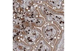Immunohistochemical staining of human duodenum with SLC22A16 polyclonal antibody  shows moderate cytoplasmic positivity in glandular cells at 1:200-1:500 dilution. (SLC22A16 抗体)