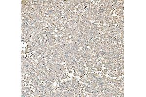 IHC analysis of PKM2 using anti-PKM2 antibody (ABIN7603151).