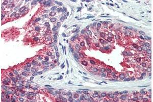 Human, Prostate: Formalin-Fixed Paraffin-Embedded (FFPE) (CDCP1 抗体  (N-Term))