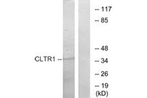 Western blot analysis of extracts from COS7 cells, using CLTR1 Antibody. (CysLTR1 抗体  (AA 131-180))