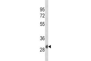 Western Blotting (WB) image for anti-Secreted Frizzled-Related Protein 1 (SFRP1) antibody (ABIN3004008) (SFRP1 抗体)