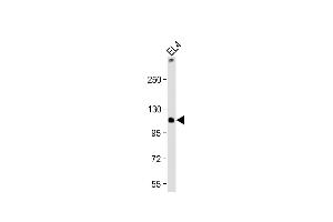 Anti-TCIRG1 Antibody (C-Term) at 1:2000 dilution + EL4 whole cell lysate Lysates/proteins at 20 μg per lane. (TCIRG1 抗体  (AA 668-702))