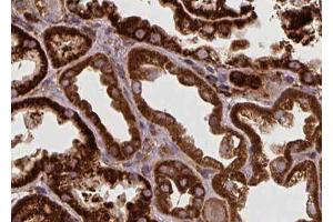 ABIN6272433 at 1/100 staining Human kidney tissue by IHC-P. (SPHK2 抗体  (N-Term))