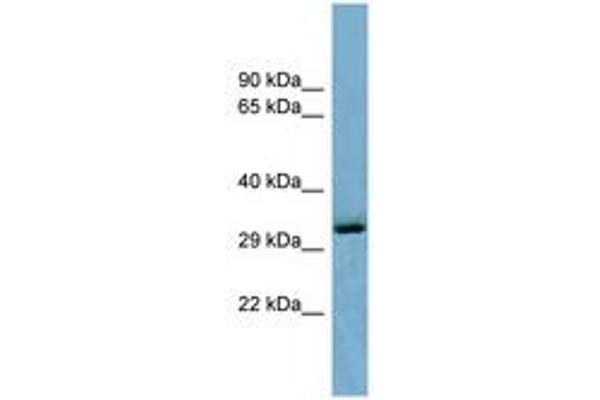 OTUD6B 抗体  (C-Term)