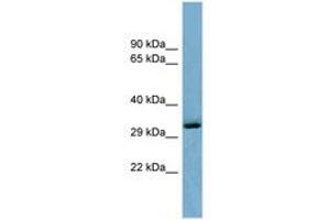 Image no. 1 for anti-OTU Domain Containing 6B (OTUD6B) (C-Term) antibody (ABIN6741941) (OTUD6B 抗体  (C-Term))