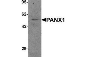 Western blot analysis of PANX1 in human ovary tissue lysate with PANX1 Antibody  at 1 μg/ml. (PANX1 抗体  (N-Term))