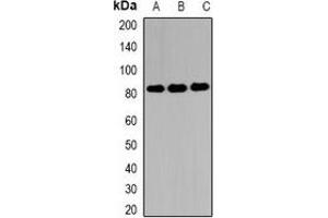 Western blot analysis of EIF4B expression in MCF7 (A), 22RV1 (B), Hela (C) whole cell lysates. (EIF4B 抗体)