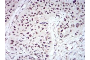 Immunohistochemistry (IHC) image for anti-Wilms Tumor 1 Associated Protein (WTAP) (AA 91-201) antibody (ABIN5880136) (WTAP 抗体  (AA 91-201))