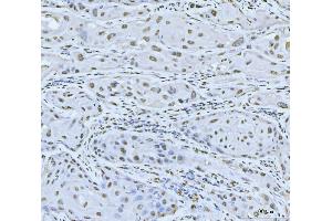 IHC analysis of MRE11 using anti-MRE11 antibody (ABIN7600025).
