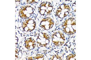 Immunohistochemistry of paraffin-embedded human colon using TOMM22 Rabbit mAb (ABIN7270930) at dilution of 1:100 (40x lens). (TOMM22 抗体)