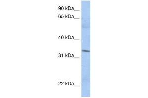MRPL15 antibody used at 1 ug/ml to detect target protein. (MRPL15 抗体  (N-Term))