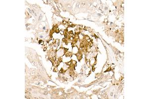 Immunohistochemistry (IHC) image for anti-Tubulin, alpha 4a (TUBA4A) antibody (ABIN7271036)