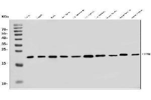 Western blot analysis of PSMB5/MB1 using anti-PSMB5/MB1 antibody (ABIN7599183).
