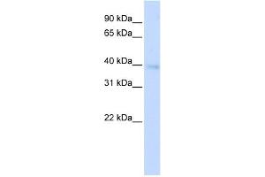 WB Suggested Anti-HOXA11 Antibody Titration: 0. (Homeobox A11 抗体  (Middle Region))