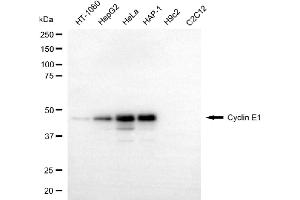 Western blotting analysis using cyclin E1 antibody (ABIN7798198). (Recombinant Cyclin E1 抗体)