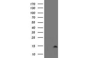 Image no. 1 for anti-Cystatin SA (CST2) antibody (ABIN1497757) (CST2 抗体)