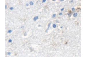 Immunohistochemistry (IHC) image for anti-Keratin 33A (KRT33A) (AA 57-363) antibody (ABIN7441730)