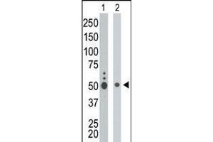 Antibody is used in Western blot to detect KIST in K562 cell lysate (Lane 1) and mouse liver tissue lysate (Lane 2).