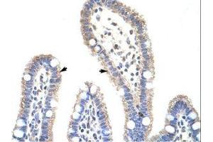 Image no. 1 for anti-Methyltransferase Like 3 (METTL3) (N-Term) antibody (ABIN202783) (METTL3 抗体  (N-Term))
