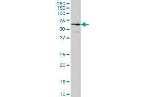 CDR2 monoclonal antibody (M01), clone 4F5 Western Blot analysis of CDR2 expression in HeLa . (CDR2 抗体  (AA 296-404))