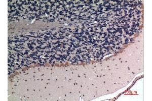 Immunohistochemistry (IHC) analysis of paraffin-embedded Rat Brain, antibody was diluted at 1:100.